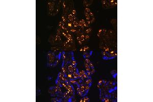 Immunofluorescence analysis of Human placenta using ApoER2/ApoER2/LRP8 antibody (ABIN6134224, ABIN6143337, ABIN6143338 and ABIN6214801) at dilution of 1:100. (LRP8 Antikörper  (C-Term))