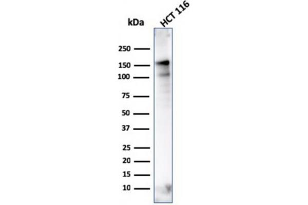 MSH6 抗体  (AA 374-540)
