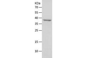 Western Blotting (WB) image for Eukaryotic Translation Initiation Factor 2A, 65kDa (EIF2A) (AA 1-315) protein (His tag) (ABIN7122841) (EIF2A Protein (AA 1-315) (His tag))