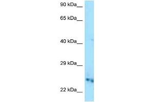 WB Suggested Anti-Cmpk1 Antibody Titration: 1.