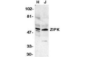 Western blot analysis of ZIP kinase in HeLa (H) and Jurkat (J) whole cell lysates with ZIAP31006PU-N at 1 μg/ml. (DAPK3 Antikörper  (Center))