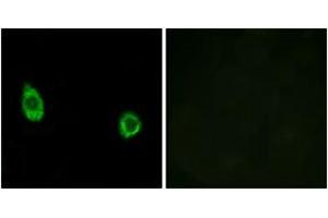 Immunofluorescence analysis of HuvEc cells, using CHST9 Antibody. (CHST9 Antikörper  (AA 361-410))