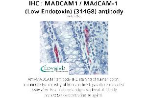 Image no. 2 for anti-Mucosal Vascular Addressin Cell Adhesion Molecule 1 (MADCAM1) antibody (ABIN5693628) (MADCAM1 Antikörper)