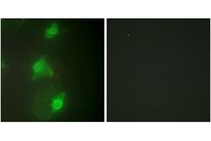 Immunofluorescence analysis of HeLa cells, using AIRE Antibody. (AIRE Antikörper  (AA 91-140))