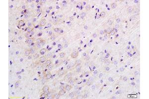 Formalin-fixed and paraffin embedded rat brain labeled with Anti-TLR1 Polyclonal Antibody, Unconjugated (ABIN736373) at 1:200 followed by conjugation to the secondary antibody and DAB staining. (TLR1 Antikörper  (AA 101-200))