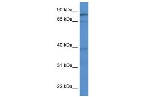 WB Suggested Anti-ZCCHC7 Antibody Titration: 0. (ZCCHC7 Antikörper  (C-Term))