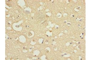 Immunohistochemistry of paraffin-embedded human brain tissue using ABIN7148022 at dilution of 1:100 (COPZ1 Antikörper  (AA 1-177))