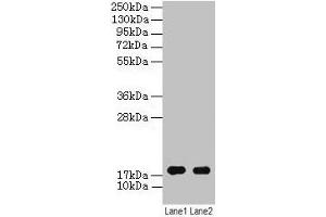 Western blot All lanes: ATP5F1D antibody at 2 μg/mL Lane 1: EC109 whole cell lysate Lane 2: 293T whole cell lysate Secondary Goat polyclonal to rabbit IgG at 1/15000 dilution Predicted band size: 18 kDa Observed band size: 18 kDa (ATP5F1D Antikörper  (AA 32-158))