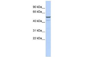 KCNK12 antibody used at 1 ug/ml to detect target protein.