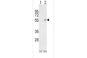 Western blot analysis of HP (arrow) using rabbit polyclonal HP Antibody (Center) (ABIN652875 and ABIN2842566). (Haptoglobin Antikörper  (Center))