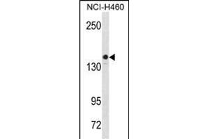 KIT Antibody  (ABIN1538599 and ABIN2850081) western blot analysis in NCI- cell line lysates (35 μg/lane). (KIT Antikörper  (AA 724-753))