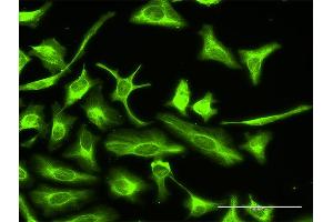 Immunofluorescence of purified MaxPab antibody to OTUB2 on HeLa cell. (OTUB2 Antikörper  (AA 1-234))