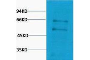 Western Blotting (WB) image for anti-Myc Proto-Oncogene protein (MYC) antibody (ABIN3181293) (c-MYC Antikörper)