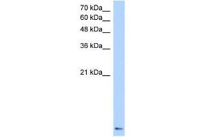 Transfected 293T; WB Suggested Anti-ZNF706 Antibody Titration: 0. (ZNF706 Antikörper  (N-Term))