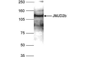 Western Blot of anti-JMJD2b antibody Western Blot results of Rabbit anti-JMJD2b antibody. (KDM4B Antikörper  (Internal Region))