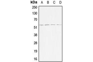 Western blot analysis of ACVR1B expression in HeLa (A), Jurkat (B), SP2/0 (C), H9C2 (D) whole cell lysates. (Activin A Receptor Type IB/ALK-4 Antikörper  (Center))