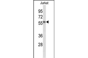 Western blot analysis of SACM1L Antibody (C-term) (ABIN653512 and ABIN2842917) in Jurkat cell line lysates (35 μg/lane).