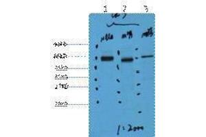 Western Blotting (WB) image for anti-Keratin 7 (KRT7) antibody (ABIN3181124)