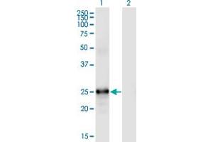 Western Blot analysis of FGF19 expression in transfected 293T cell line by FGF19 monoclonal antibody (M01), clone 4C4. (FGF19 Antikörper  (AA 1-216))