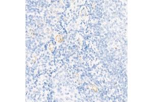 Immunohistochemistry (IHC) image for anti-Caspase 7, Apoptosis-Related Cysteine Peptidase (CASP7) (AA 24-303) antibody (ABIN3022072)