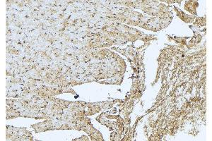ABIN6273408 at 1/100 staining Mouse muscle tissue by IHC-P. (TNNT3 Antikörper  (C-Term))