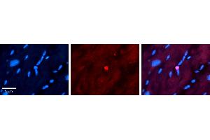 Rabbit Anti-APTX Antibody   Formalin Fixed Paraffin Embedded Tissue: Human heart Tissue Observed Staining: Nucleus Primary Antibody Concentration: 1:100 Other Working Concentrations: N/A Secondary Antibody: Donkey anti-Rabbit-Cy3 Secondary Antibody Concentration: 1:200 Magnification: 20X Exposure Time: 0.