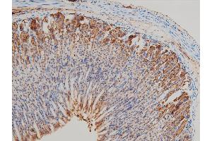 Immunohistochemistry (IHC) image for anti-LIM Domain Kinase 1 (LIMK1) (pThr508) antibody (ABIN6255701)