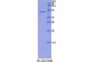 SDS-PAGE analysis of Mouse Profilin 1 Protein.