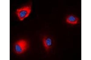 Immunofluorescent analysis of ANAPC1 (pS688) staining in HEK293T cells.