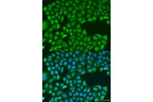 Immunofluorescence analysis of U2OS cells using TIRAP antibody. (TIRAP Antikörper  (AA 1-221))