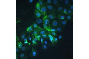 anti-Cortactin (CTTN) (AA 1-105) antibody