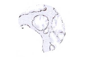 Strong KRT14 positivity in basal cells of the prostate (Rekombinanter KRT14 Antikörper  (AA 350-472))