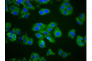 Immunofluorescence staining of HepG2 cells with ABIN7148706 at 1:200, counter-stained with DAPI. (CTAGE1 Antikörper  (AA 471-595))