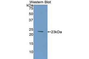 Western blot analysis of the recombinant protein. (COL6A1 Antikörper  (AA 828-1022))