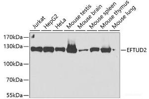 Western blot analysis of extracts of various cell lines using EFTUD2 Polyclonal Antibody at dilution of 1:2000. (EFTUD2 Antikörper)