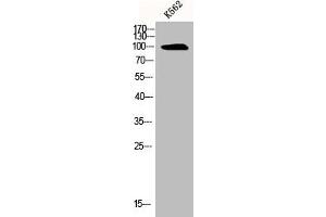 Western Blotting (WB) image for anti-Solute Carrier Family 4, Sodium Borate Transporter, Member 11 (SLC4A11) (Internal Region) antibody (ABIN7186031)