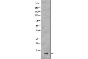 Western blot analysis of ASC2 using HepG2 whole cell lysates (PYDC1 Antikörper)