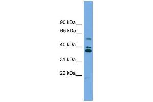 Western Blotting (WB) image for anti-Low Density Lipoprotein Receptor Class A Domain Containing 3 (LDLRAD3) (Middle Region) antibody (ABIN2785332)