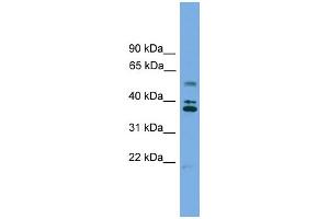 WB Suggested Anti-LDLRAD3 Antibody Titration: 0. (LDLRAD3 Antikörper  (Middle Region))