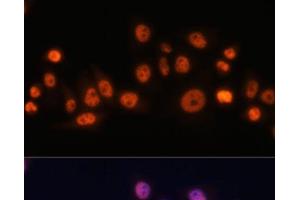 Immunofluorescence analysis of HeLa cells using EFTUD2 Polyclonal Antibody at dilution of 1:100. (EFTUD2 Antikörper)