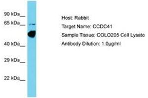 Image no. 1 for anti-Coiled-Coil Domain Containing 41 (CCDC41) (AA 148-197) antibody (ABIN6750609)