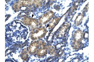 SP140 antibody was used for immunohistochemistry at a concentration of 4-8 ug/ml to stain Epithelial cells of renal tubule (arrows) in Human Kidney. (SP140 Antikörper  (N-Term))