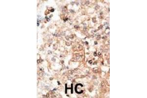 Immunohistochemistry (IHC) image for anti-Osteocalcin (BGLAP) antibody (ABIN3001265) (Osteocalcin Antikörper)