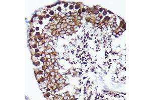 Immunohistochemistry of paraffin-embedded rat testis using PRMT5 antibody (ABIN7269605) at dilution of 1:100 (40x lens). (PRMT5 Antikörper)