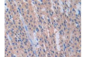 DAB staining on IHC-P; Samples: Rat Stomach Tissue (PANX1 Antikörper  (AA 77-260))