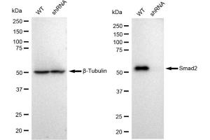 Western blotting analysis using Smad2 antibody (ABIN7800371).