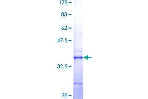 Image no. 1 for Treacher Collins-Franceschetti Syndrome 1 (TCOF1) (AA 2-82) protein (GST tag) (ABIN1322405) (TCOF1 Protein (AA 2-82) (GST tag))