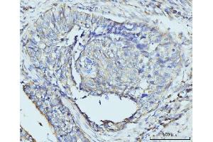 IHC analysis of RPL23 using anti-RPL23 antibody (ABIN7599808). (RPL23 Antikörper  (AA 12-136))
