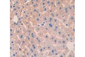 Used in DAB staining on fromalin fixed paraffin- embedded Kidney tissue (BCL10 Antikörper  (AA 1-233))