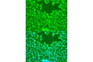Immunofluorescence analysis of U2OS cells using TAZ antibody (ABIN7271395) at dilution of 1:100. (WWTR1 Antikörper  (C-Term))